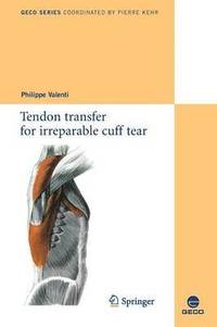 bokomslag Tendon transfer for irreparable cuff tear