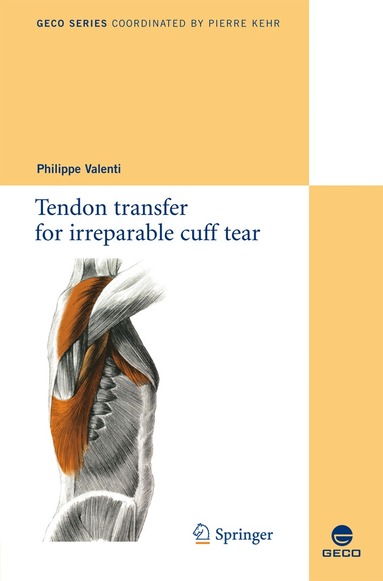 bokomslag Tendon transfer for irreparable cuff tear