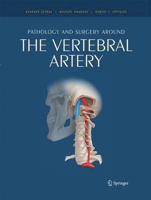 Pathology and surgery around the vertebral artery 1