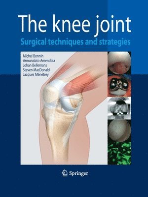 The Knee Joint 1