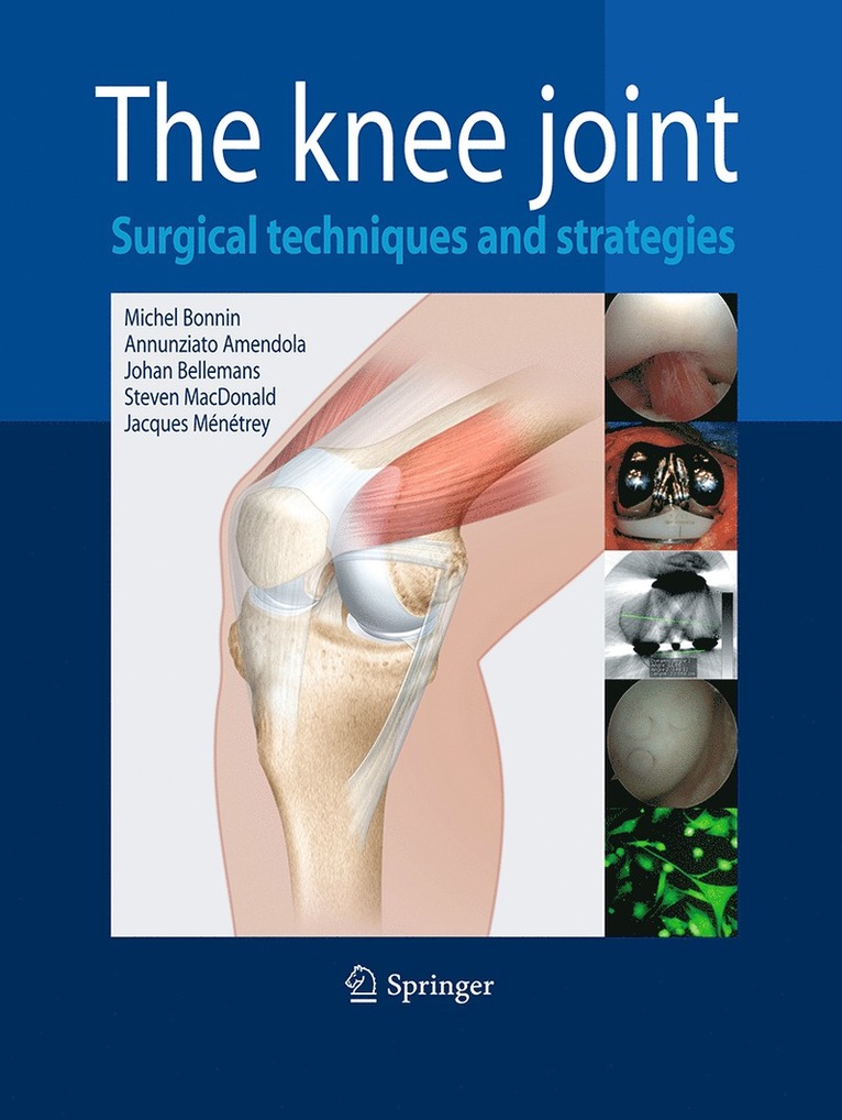Michel Bonnin, Ned Annunziato Amendola, Johan Bellemans, Steven J. MacDonald, Jacques Menetrey - Knee Joint, Häftad