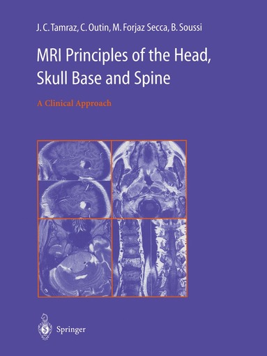 bokomslag MRI Principles of the Head, Skull Base and Spine