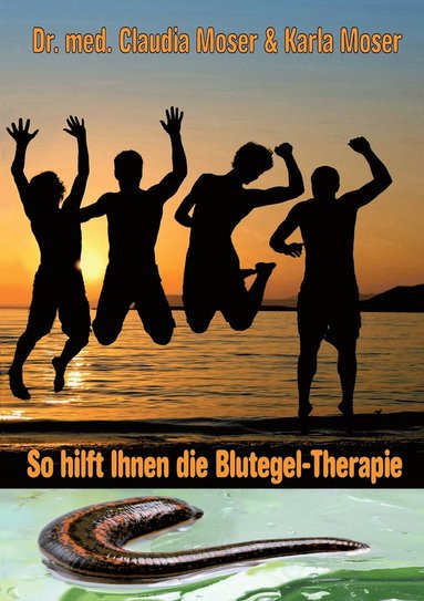 bokomslag So hilft ihnen die Blutegeltherapie