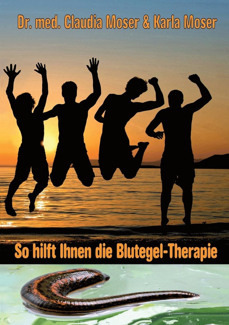 So hilft ihnen die Blutegeltherapie 1