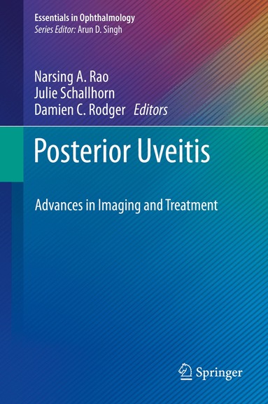 Narsing A. Rao, Julie Schallhorn, Damien C. Rodger - Posterior Uveitis, Inbunden