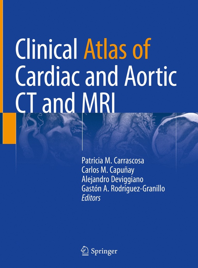 Patricia M. Carrascosa, Carlos M. Capuñay, Alejandro Deviggiano, Gaston A. Rodriguez-Granillo, Carlos M. Capunay - Clinical Atlas of Cardiac and Aortic CT and MRI, Inbunden