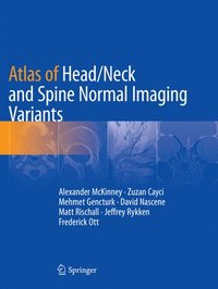 bokomslag Atlas of Head/Neck and Spine Normal Imaging Variants