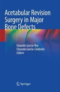 bokomslag Acetabular Revision Surgery in Major Bone Defects