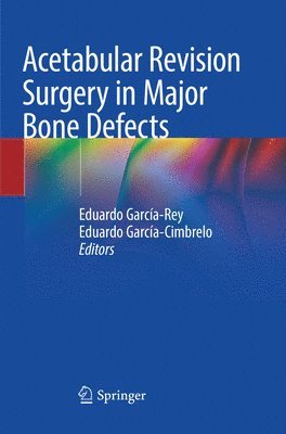 Acetabular Revision Surgery in Major Bone Defects 1