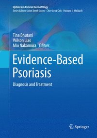bokomslag Evidence-Based Psoriasis