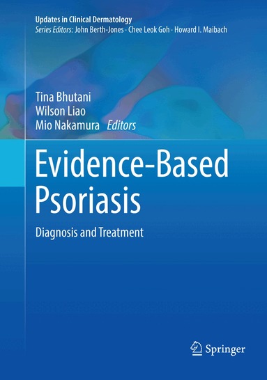 Tina Bhutani, Wilson Liao, Mio Nakamura - Evidence-Based Psoriasis, Häftad