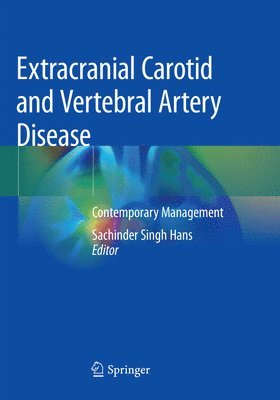 bokomslag Extracranial Carotid and Vertebral Artery Disease