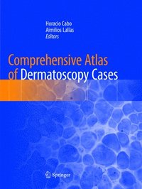 bokomslag Comprehensive Atlas of Dermatoscopy Cases