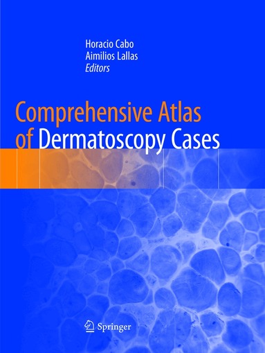 Horacio Cabo, Aimilios Lallas - Comprehensive Atlas of Dermatoscopy Cases, Häftad