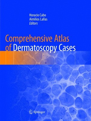 Comprehensive Atlas of Dermatoscopy Cases 1