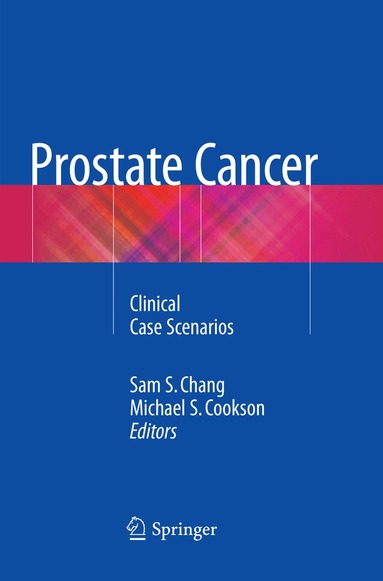 Sam S. Chang, Michael S. Cookson - Prostate Cancer, Häftad