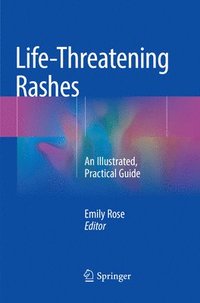 bokomslag Life-Threatening Rashes