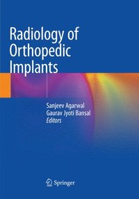 bokomslag Radiology of Orthopedic Implants