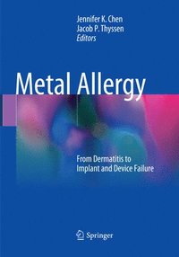 bokomslag Metal Allergy