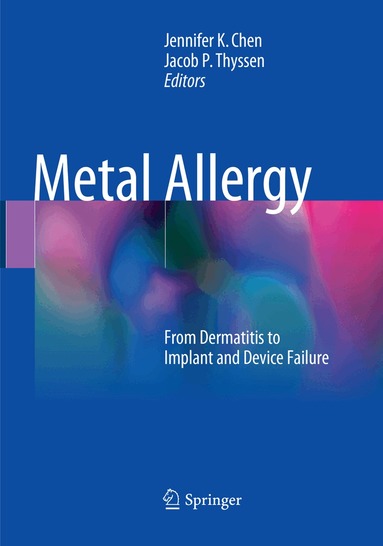 Jennifer K Chen, Jacob P. Thyssen - Metal Allergy, Häftad