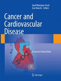 bokomslag Cancer and Cardiovascular Disease