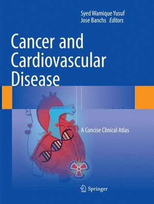 bokomslag Cancer and Cardiovascular Disease