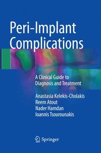 bokomslag Peri-Implant Complications