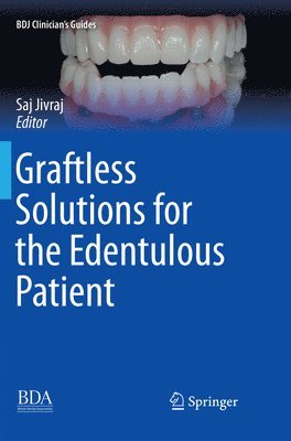 Graftless Solutions for the Edentulous Patient 1