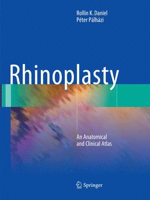 Rhinoplasty 1