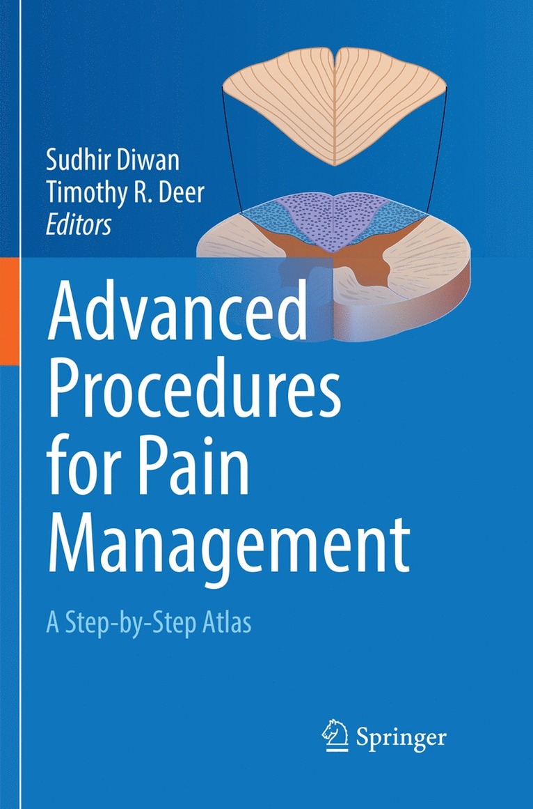 Sudhir Diwan, Timothy R Deer, Timothy R. Deer - Advanced Procedures for Pain Management, Häftad
