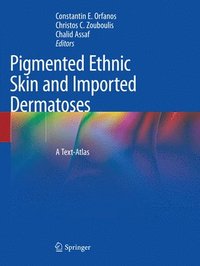 bokomslag Pigmented Ethnic Skin and Imported Dermatoses