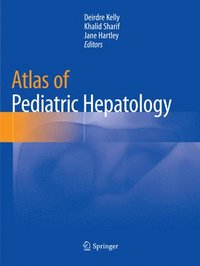bokomslag Atlas of Pediatric Hepatology
