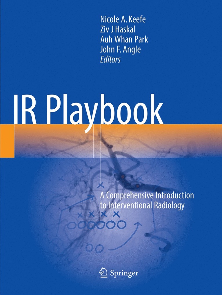 IR Playbook