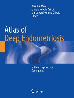 bokomslag Atlas of Deep Endometriosis
