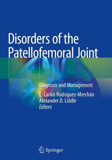 E. Carlos Rodríguez-Merchán, Alexander D. Liddle - Disorders of the Patellofemoral Joint, Häftad