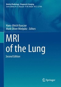 bokomslag MRI of the Lung