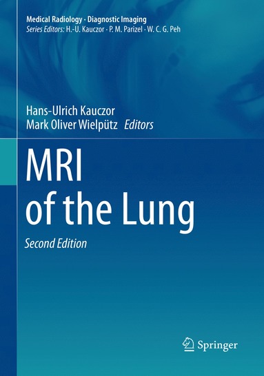 bokomslag MRI of the Lung