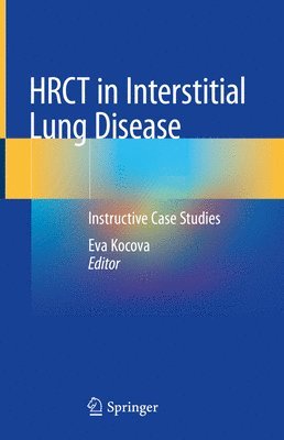 bokomslag HRCT in Interstitial Lung Disease