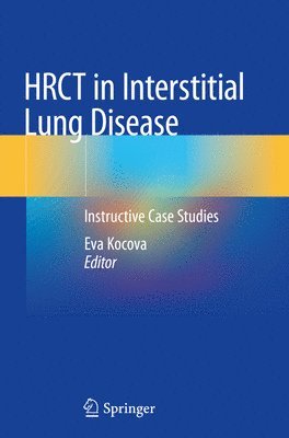 bokomslag HRCT in Interstitial Lung Disease