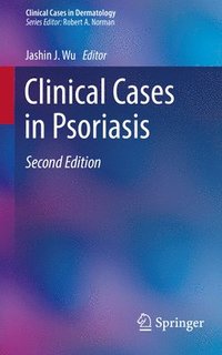 bokomslag Clinical Cases in Psoriasis