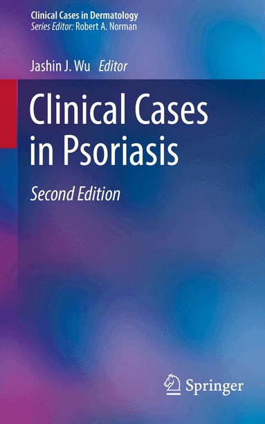 Jashin J. Wu - Clinical Cases in Psoriasis, Häftad