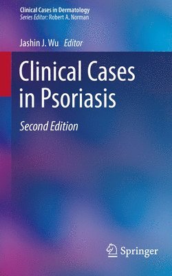 bokomslag Clinical Cases in Psoriasis