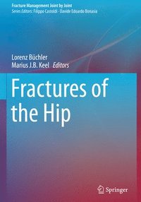 bokomslag Fractures of the Hip