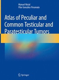 bokomslag Atlas of Peculiar and Common Testicular and Paratesticular Tumors