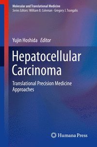 bokomslag Hepatocellular Carcinoma