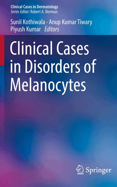 Sunil Kothiwala, Anup Kumar Tiwary, Piyush Kumar - Clinical Cases in Disorders of Melanocytes, Häftad