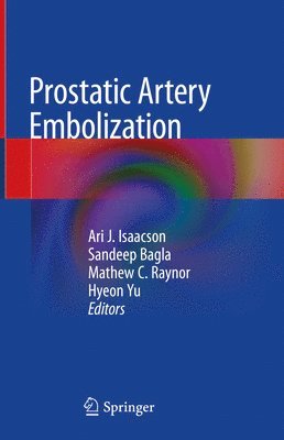 Prostatic Artery Embolization 1