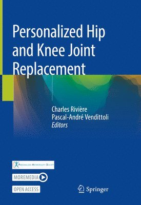 Personalized Hip and Knee Joint Replacement 1
