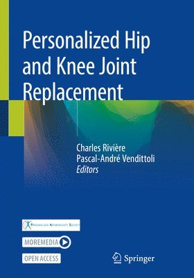 Personalized Hip and Knee Joint Replacement 1