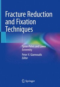 bokomslag Fracture Reduction and Fixation Techniques